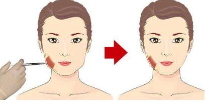 飛頓彩光嫩膚能有效祛斑嗎？注意事項有哪些呢？