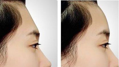 上海手術(shù)除皺醫(yī)院哪家好？排名、評(píng)價(jià)、費(fèi)用對(duì)比全面解析