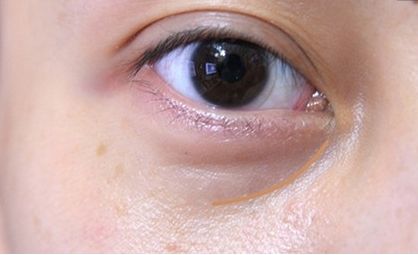 常德市整形美容科醫(yī)院：醫(yī)術(shù)高超，手術(shù)安全可靠，絕對(duì)給您信心！推薦這些醫(yī)院！