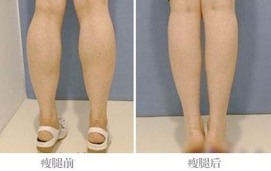 武漢哪家熱瑪吉醫(yī)院最好？一起來了解一下！