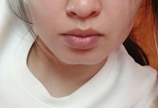 海南整形醫(yī)院測評(píng)名單公示：哪些公立、私立醫(yī)美成當(dāng)下熱門趨勢？哪家醫(yī)院口碑比較好？