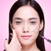 臺州祛魚尾紋醫(yī)院：有效消除眼角細紋！