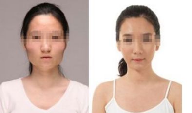 上海眼紋射頻去除醫(yī)院排行榜出爐，前十強評測！