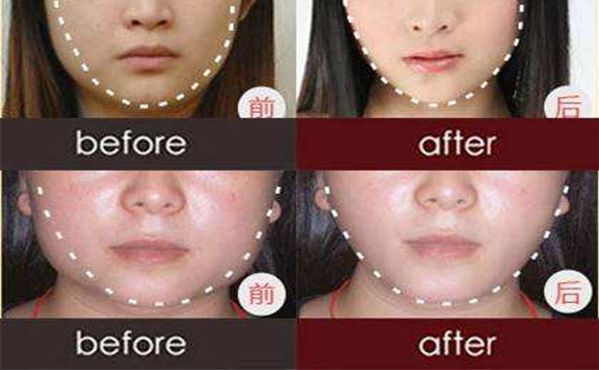 祛抬頭紋前線！權(quán)威醫(yī)院榜單搶先覽