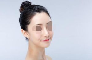 廣州祛痘坑激光磨皮醫(yī)院口碑推薦：前十強實力榜單