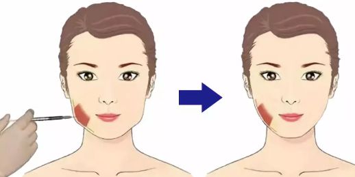 上海正璞疤痕修復(fù)技術(shù)，告別疤痕煩惱！