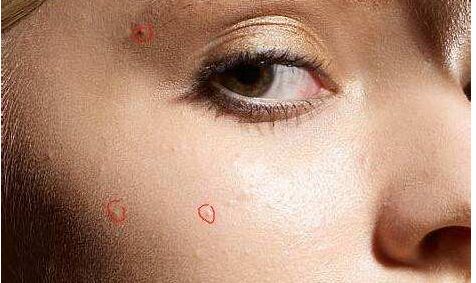 深圳更有口碑的整形醫(yī)生專家排名，告訴你隆胸王子曹孟君與雙眼皮女王劉月的獨(dú)門技藝！