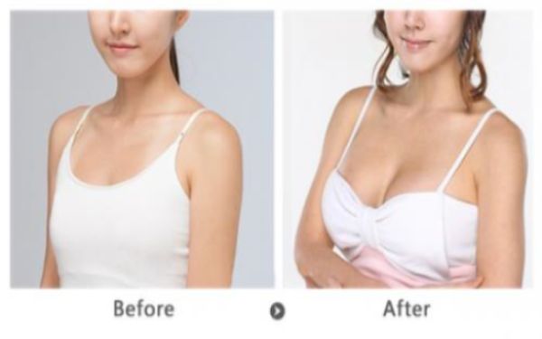 上海眼綜三美毛囊移植醫(yī)院的治療資訊