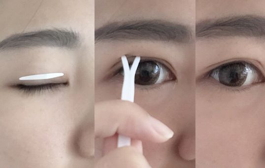 阜陽自體脂肪填充豐淚溝哪家醫(yī)院好？2023年排名前10名盤點(diǎn)！