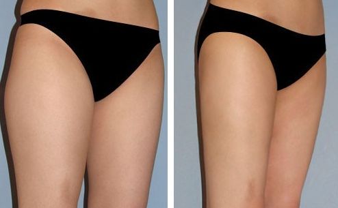 探尋遼寧哪家醫(yī)院好，取奧美定治療哪家醫(yī)院更靠譜？