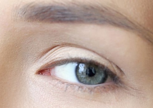 湖州整形醫(yī)院，祛除眼周細(xì)紋效果好的有哪些？：2023湖州皮秒激光祛除眼周細(xì)紋醫(yī)院排名前十名