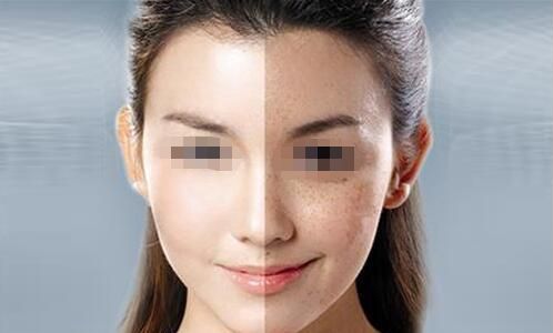 北京哪家整容醫(yī)院好且價格合適？