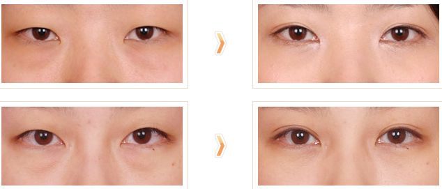 泰安激光點(diǎn)痣手術(shù)哪家醫(yī)院好？