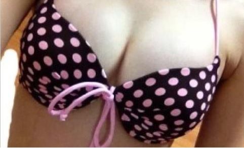 在珠海哪家醫(yī)院割雙眼皮效果好且價格合理？