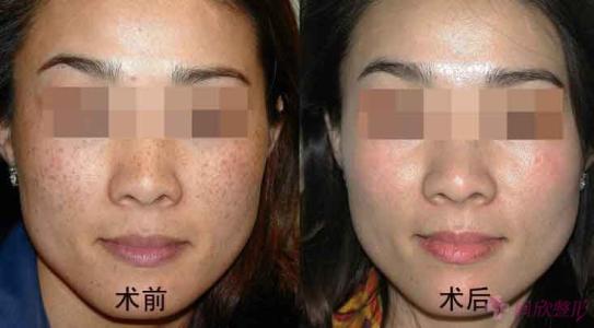 昆明豐額頭比較好的整形醫(yī)院是哪家？2023年TOP10醫(yī)院揭曉！