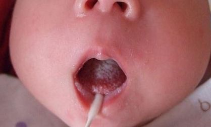 上海哪家醫(yī)院去狐臭好？專家推薦的治療狐臭最佳醫(yī)院大揭秘！