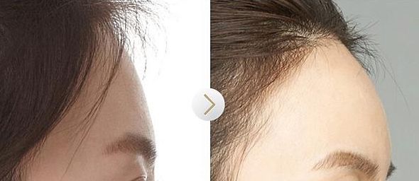 南通整形隆胸醫(yī)院哪家好？南通市整形美容醫(yī)院哪家做整容效果好？