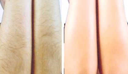 泰安哪家假體隆胸醫(yī)院好？醫(yī)生經(jīng)驗豐富，手術(shù)技術(shù)專業(yè)的推薦匯總