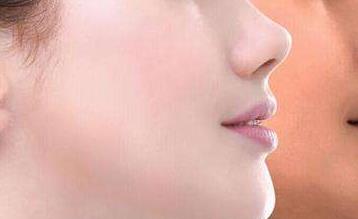 2023泉州哪家整形美容醫(yī)院除皺效果出眾？整形大型醫(yī)院排名揭曉！快速了解！