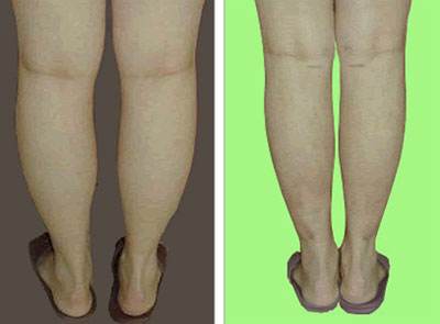 長沙電波拉皮面部緊致提升整形醫(yī)院性價比排行榜2023！推薦十家高性價比醫(yī)院