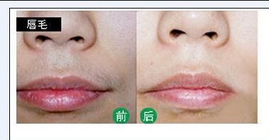 株洲哪家醫(yī)院的美容科好？美容項(xiàng)目有哪些選擇？