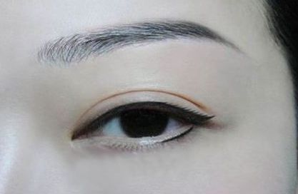 上海哪家雙眼皮美容醫(yī)院比較好？享譽口碑的推薦