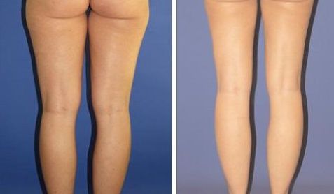 南昌整形美容科那家醫(yī)院好？2023南昌整形美容科頂級醫(yī)院推薦