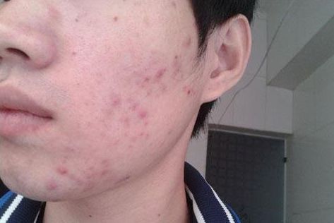 深圳整容界才子才女齊聚！隆鼻權(quán)威大神詳解！