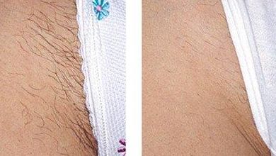 常州激光去色斑效果好的正規(guī)醫(yī)院推薦