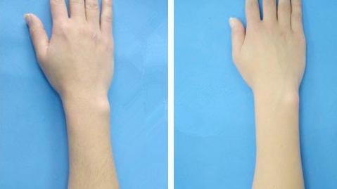 什么時間最適合進行跑步減肥？