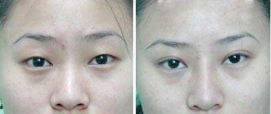 2023年吉林市假體豐胸醫(yī)院排名及綜合推薦