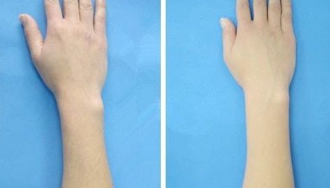 合肥哪家玻尿酸下巴好？權(quán)威醫(yī)生推薦的合肥玻尿酸下巴整形醫(yī)院排行榜