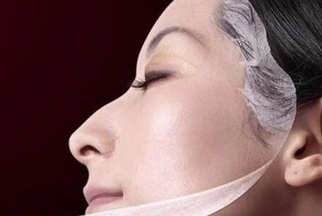 成都哪家醫(yī)院的拉皮除皺效果好？