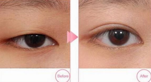 深圳哪家醫(yī)院提供專業(yè)的點(diǎn)陣治療服務(wù)？