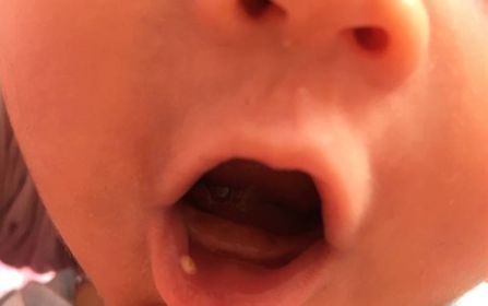 探尋青島吸脂整形專業(yè)醫(yī)院，解答哪家醫(yī)院在吸脂整形領(lǐng)域有良好口碑？