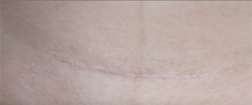 減脂瘦腿的方法果真有效嗎？最新瘦腿技巧大揭秘！