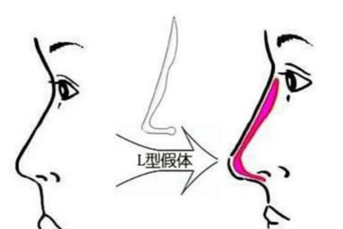 山大二院整形修復(fù)外科口碑好嗎？哪些醫(yī)生擅長(zhǎng)特色項(xiàng)目？