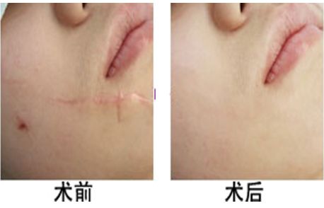 最佳隱形石家莊整形醫(yī)院排名揭秘｜高度贊譽(yù)的醫(yī)療機(jī)構(gòu)名單公開(kāi)