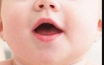 太原哪家醫(yī)院做激光祛痘好？醫(yī)院選擇攻略解析來(lái)了！