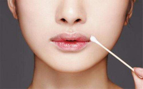 北京四美美容整形醫(yī)院是不是靠譜的？有沒(méi)有患者反饋？