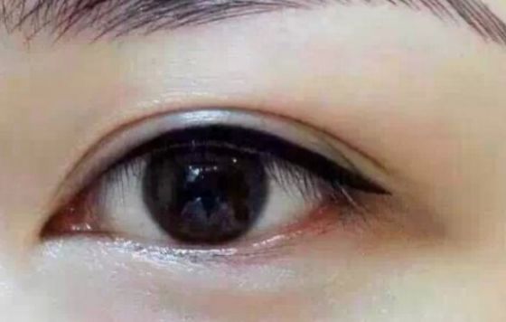 從北京減肥醫(yī)院中選擇最好的方法