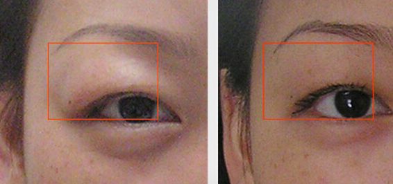 貴陽胸部整形美容醫(yī)院推薦！醫(yī)療實力與特色出眾！一文了解！