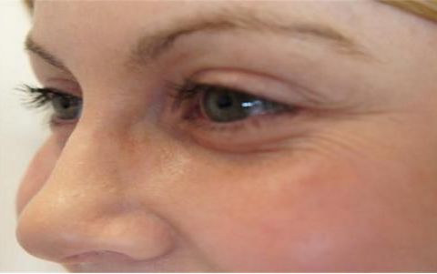 成都疤痕哪家醫(yī)院效果好？實(shí)力醫(yī)院推薦，讓你恢復(fù)自信！