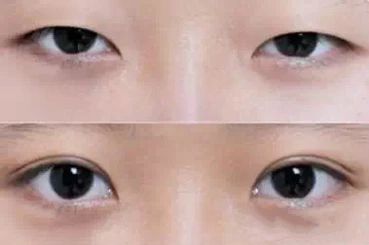 揭秘尹正整容真相！身邊相貌大變引發(fā)猜測