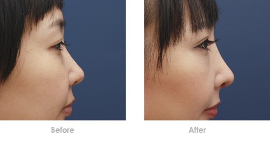 2023年，北京市面部整形美容領(lǐng)域中值得信賴的機(jī)構(gòu)有哪些？全面解析北京地區(qū)專業(yè)的面部綜合青春整形醫(yī)院排行