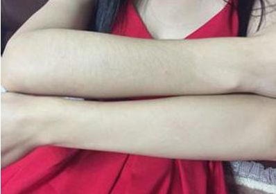 杭州激光整形哪家醫(yī)院好？綜合排名前三的杭州激光整形醫(yī)院推薦