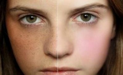 北京明星整形醫(yī)院哪家好？實(shí)力對(duì)比，選擇最適合自己的明星整形醫(yī)院