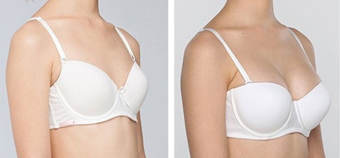 南寧哪家醫(yī)院專業(yè)去除眼部細紋效果好？2023年熱瑪吉療法被推薦的醫(yī)院列表揭曉！