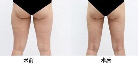 南京雙眼皮修復(fù)醫(yī)院哪家好？權(quán)威醫(yī)院排行榜揭曉！