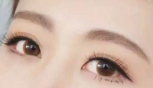 寧波哪家醫(yī)療美容醫(yī)院重瞼失敗修復(fù)效果好？2023年排名榜前幾家醫(yī)療整形醫(yī)院強(qiáng)強(qiáng)對(duì)比！